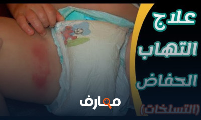 علاج الأمراض الجلدية باستخدام مستحضرات الصيدلة course preview
