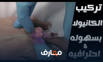 إتقان تركيب وإزالة الكانيولا خطوة بخطوة course preview