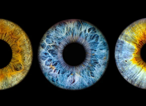 Eye Color: Percentage of the World Population With Each Shade