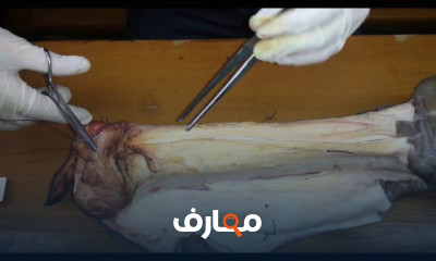 أنواع الخياطة الجراحية: دليل شامل course preview