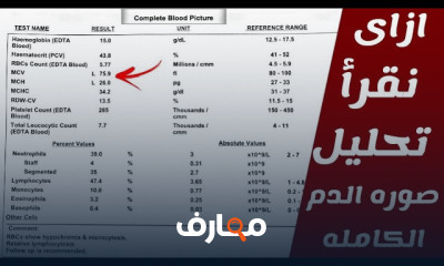 تحليل وفهم التحاليل الطبية في مجال الصيدلة course preview