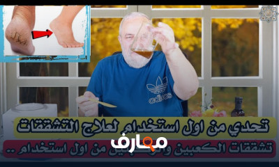 استراتيجيات فعالة لعلاج تشققات القدم والكوعين course preview
