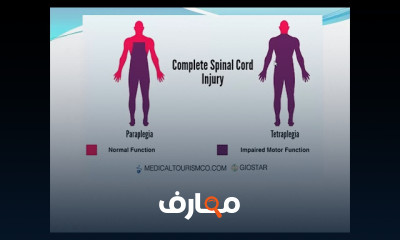 أساسيات العلاج الطبيعي course preview