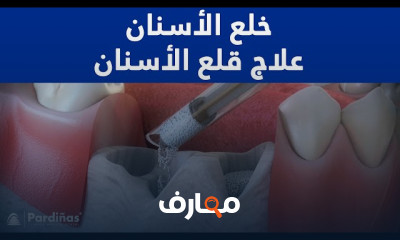 علاج مشكلات الفم والأسنان course preview