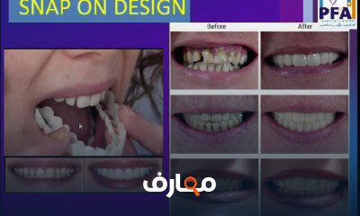تخصص فني الأسنان course preview