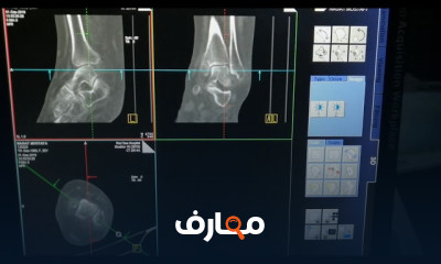 دورة متقدمة في الأشعة المقطعية course preview