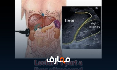 إتقان سونار البطن: من الأساسيات إلى الاحتراف course preview