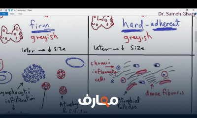 أساسيات علم أمراض الغدد الصماء course preview
