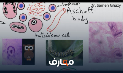 فهم أمراض القلب والأوعية الدموية course preview
