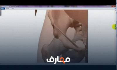 التشريح التطبيقي والسطحي للأطراف السفلية course preview