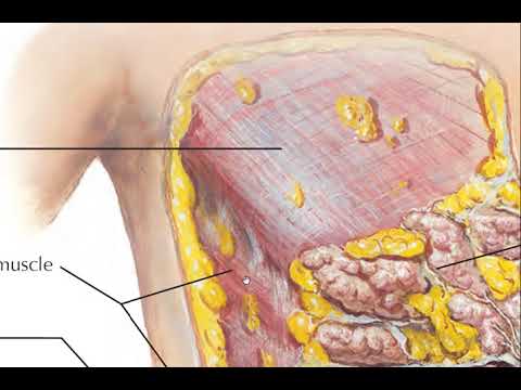 Understanding Skin Fascia course preview